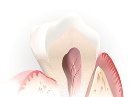 Animated inside of tooth used to explain root canal treatment