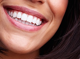 Flawless smile after gum recontouring and crown lengthening