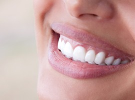 Closeup of healthy smile after antibiotic therapy