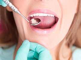 Closeup of smile receiving dental exam after tooth colored filling placement